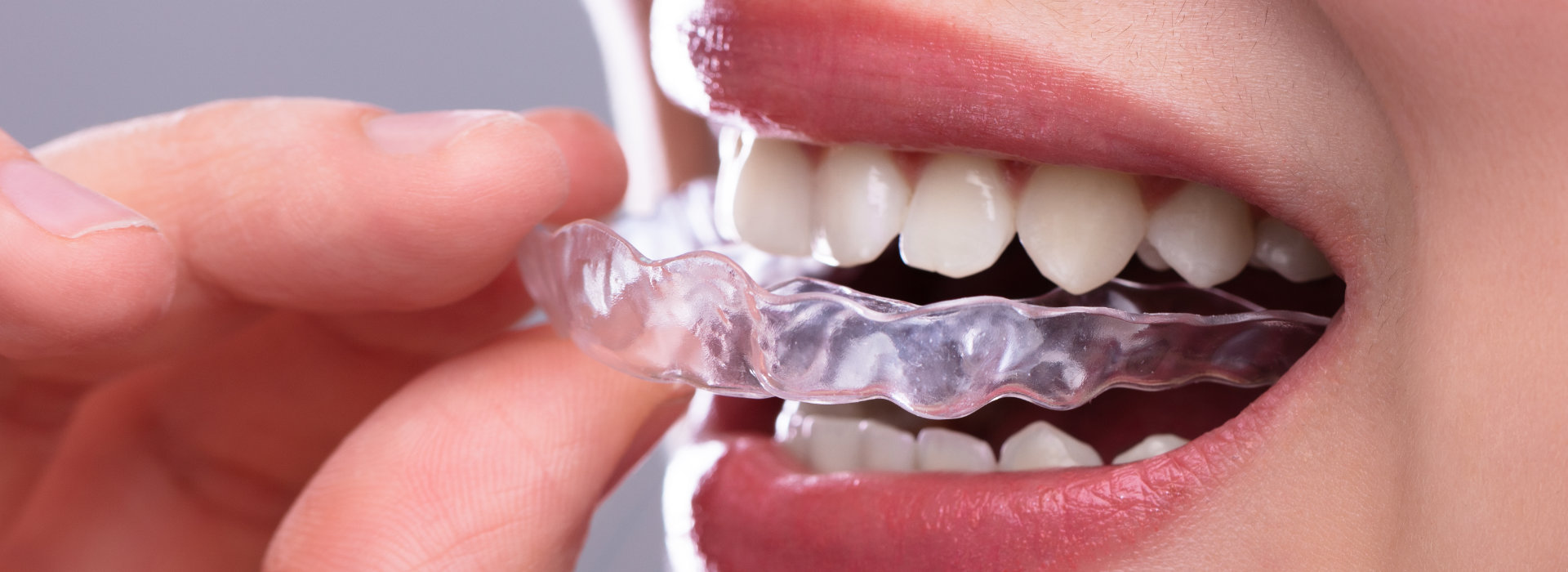 A woman is using a invisalign braces.
